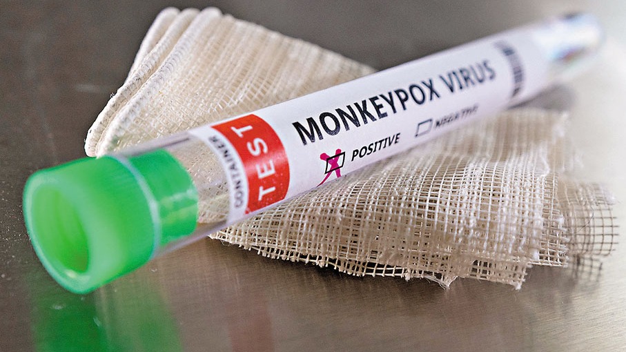 比利時強制隔離猴痘患者　英童重症入ICU