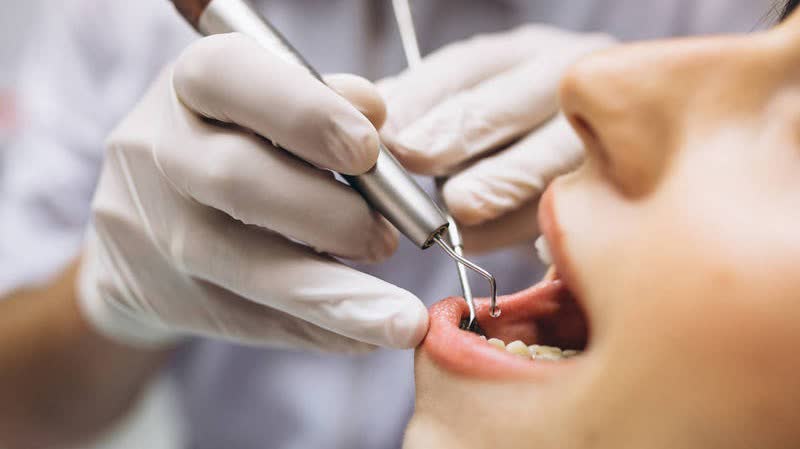 牙醫註冊修例草案明刊憲　引入非本地培訓牙醫