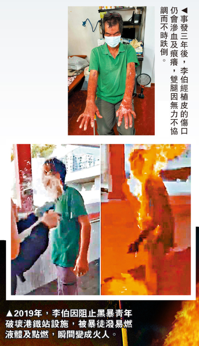 慘遭火燒/李伯：嚴懲亂港分子還社會安寧