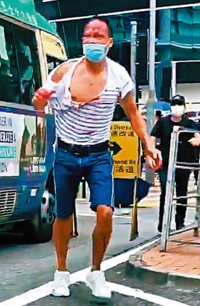 無辜被毆/陳子遷：終於等到這一天了！