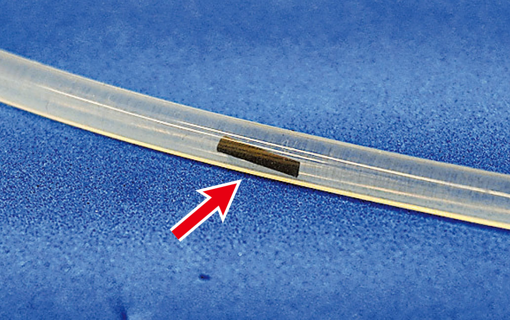 ■磁性水凝膠微型機械人（箭嘴示），可對抗小型管狀醫療植入物內形成的菌膜。    中大圖片