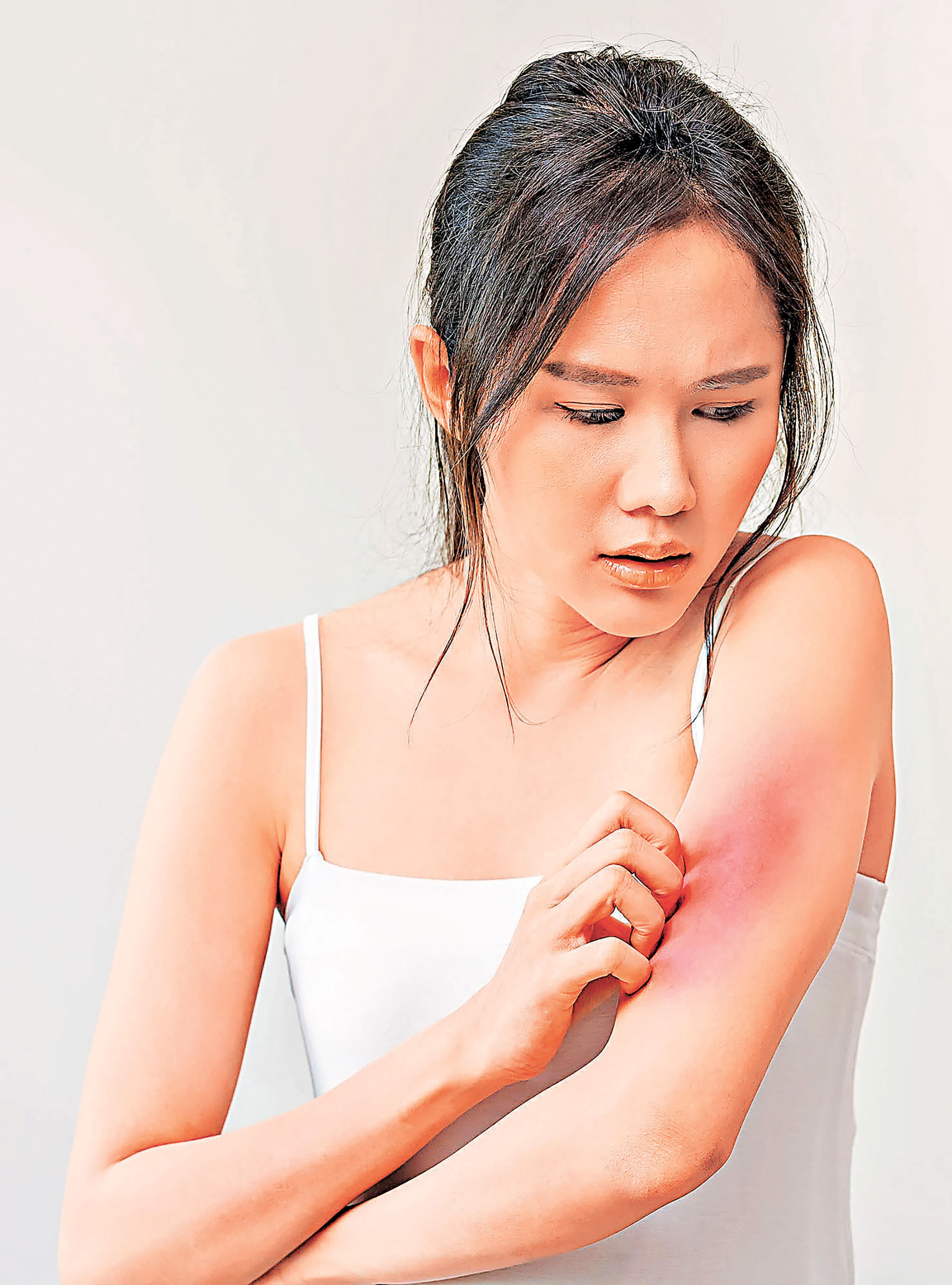 ■皮膚痕癢令人不自覺𢱑起來。