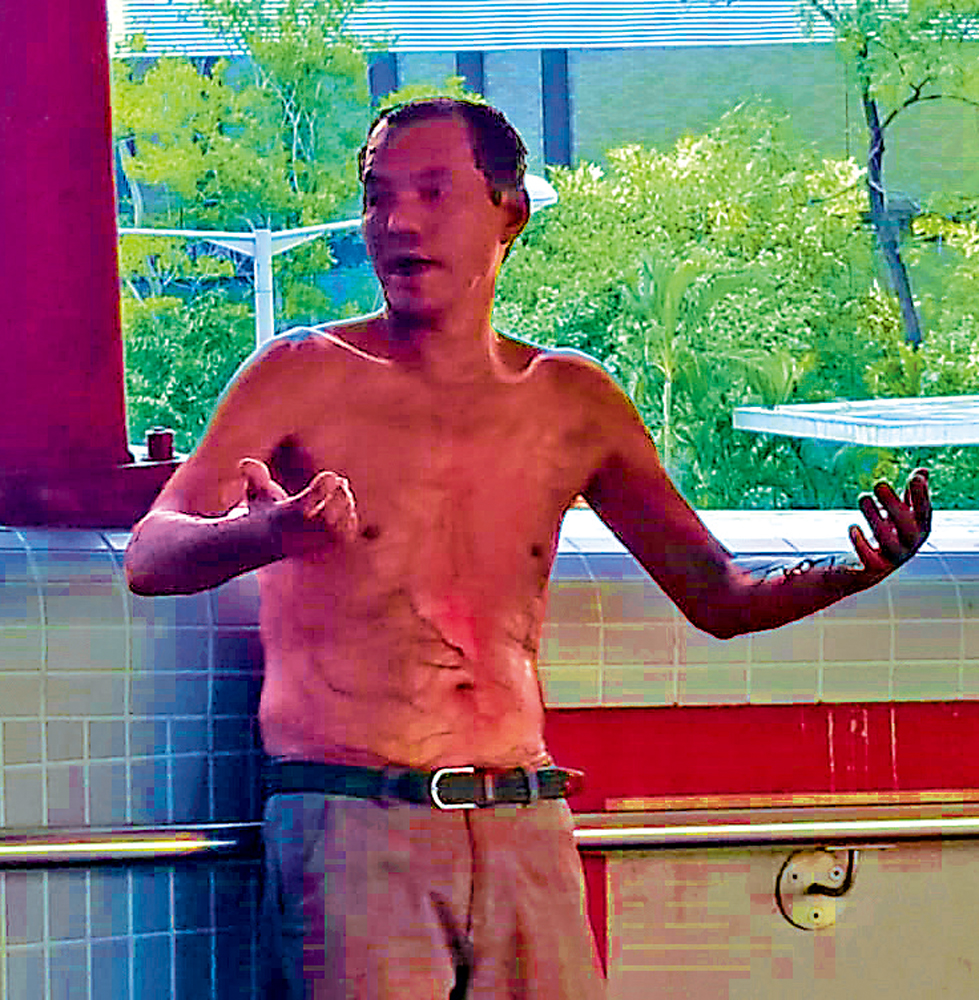 　　圖：男子全身四成皮膚二級燒傷，送院危殆