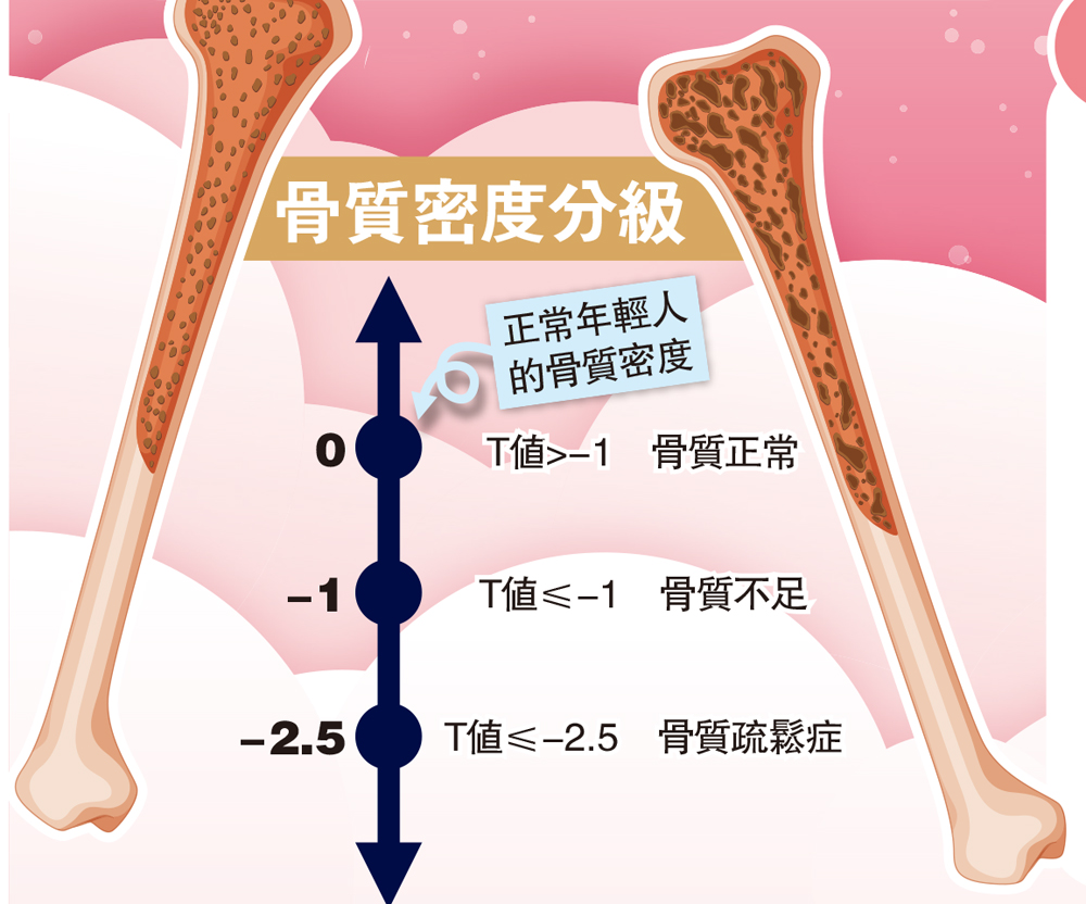 　　圖：骨質密度分級