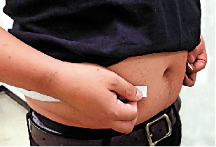 　　圖：現代糖尿病人多以肥胖為特徵。