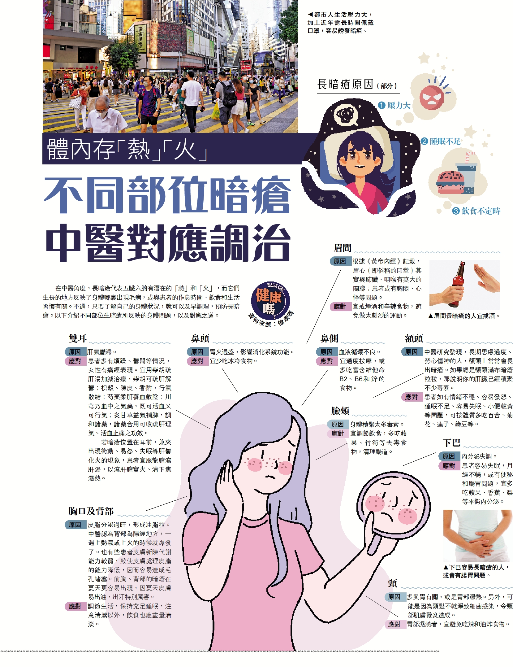 　　圖：都市人生活壓力大，加上近年需長時間佩戴口罩，容易誘發暗瘡。