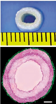 　　圖：上方為生物複合型人工血管實物圖，下方為顯微照片顯示血管兩層結構。/受訪者供圖