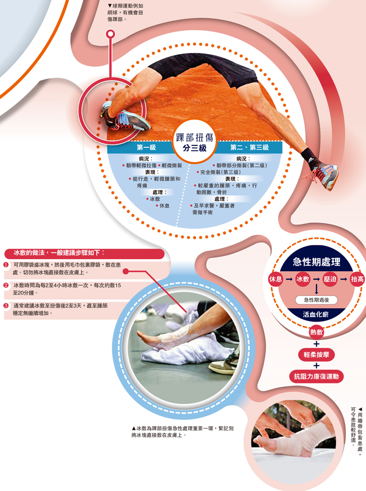 圖:球類運動例如網球,有機會扭傷踝部。