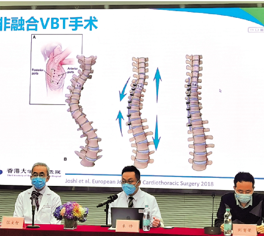 　　圖：港大深圳醫院院長張文智教授在發布會上介紹VBT技術原理。/大公報記者郭若溪攝