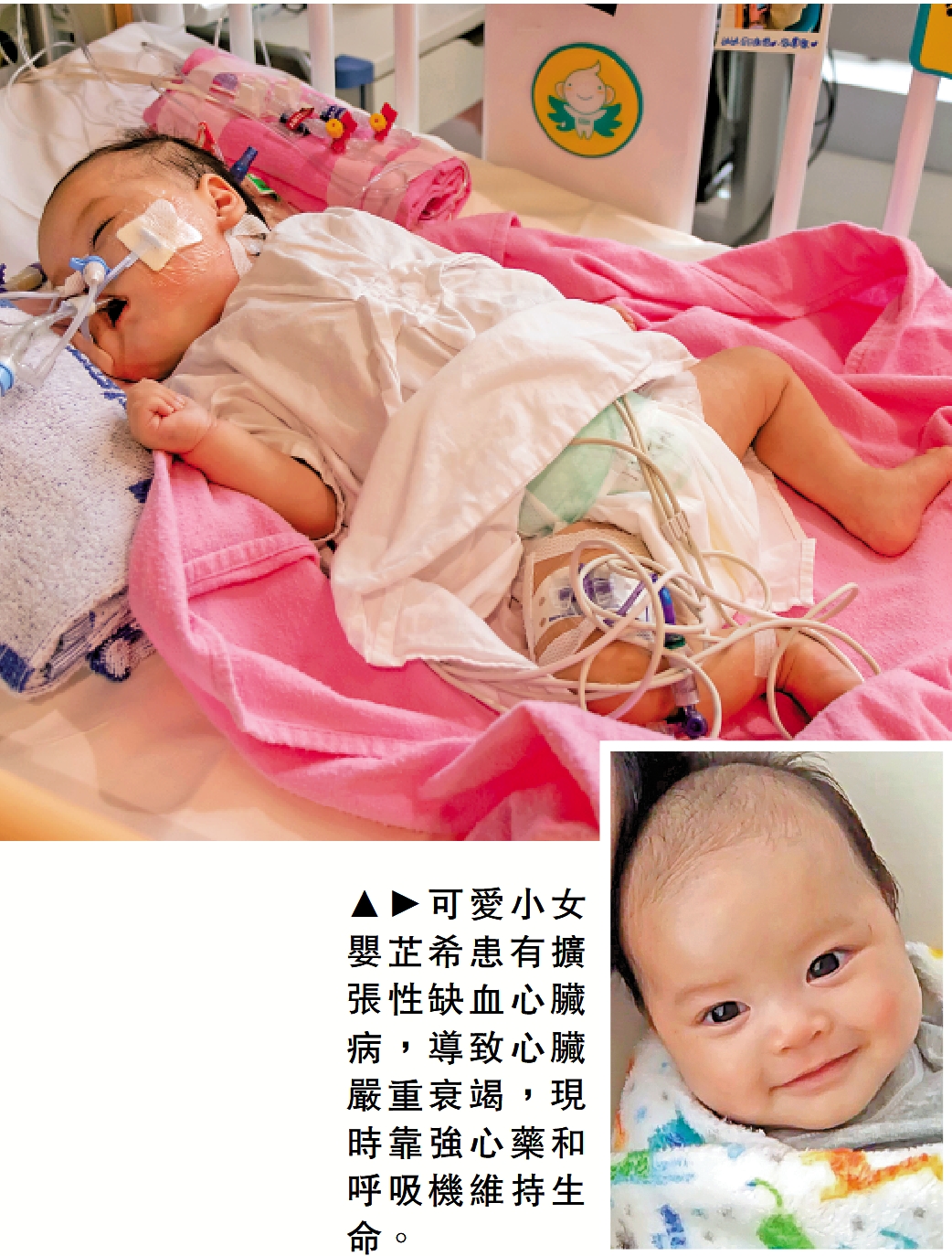 　　圖：可愛小女嬰芷希患有擴張性缺血心臟病，導致心臟嚴重衰竭，現時靠強心藥和呼吸機維持生命。