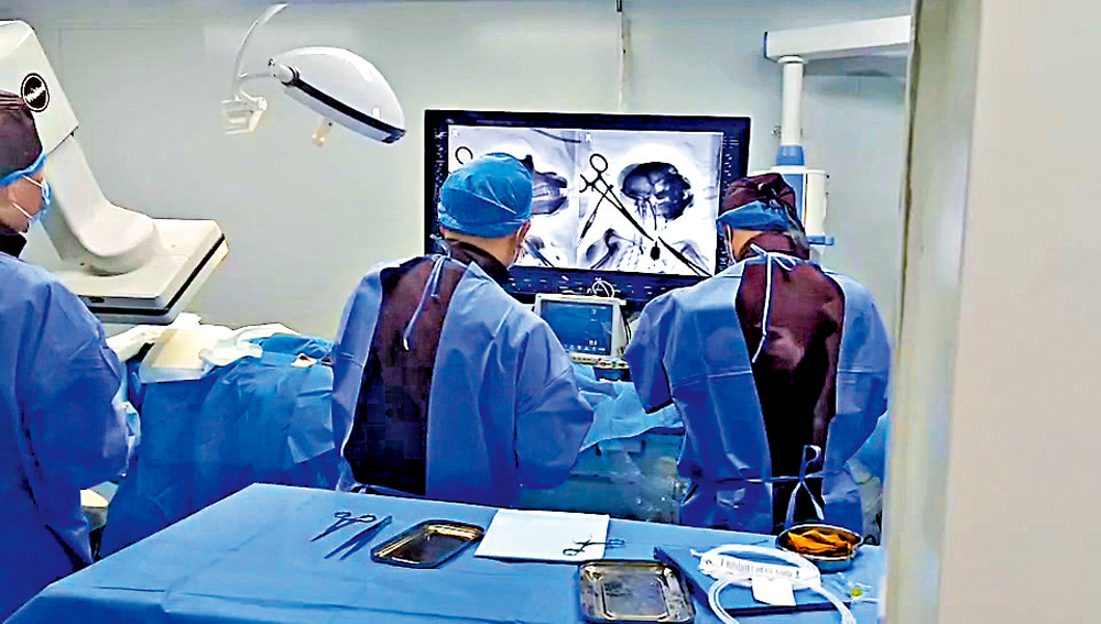 　　圖：介入式腦機接口非人靈長類動物試驗手術實景。\受訪者供圖