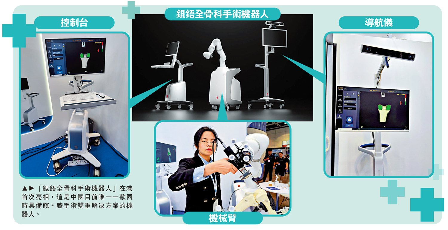　　圖：「錕鋙全骨科手術機器人」在港首次亮相，這是中國目前唯一一款同時具備髖、膝手術雙重解決方案的機器人。