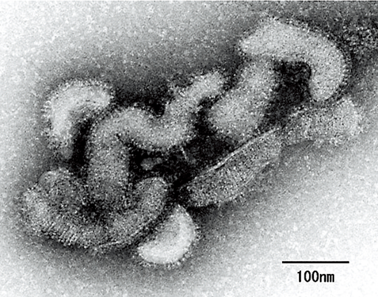 　　圖：奧茲病毒的電子顯微鏡圖像。\網絡圖片
