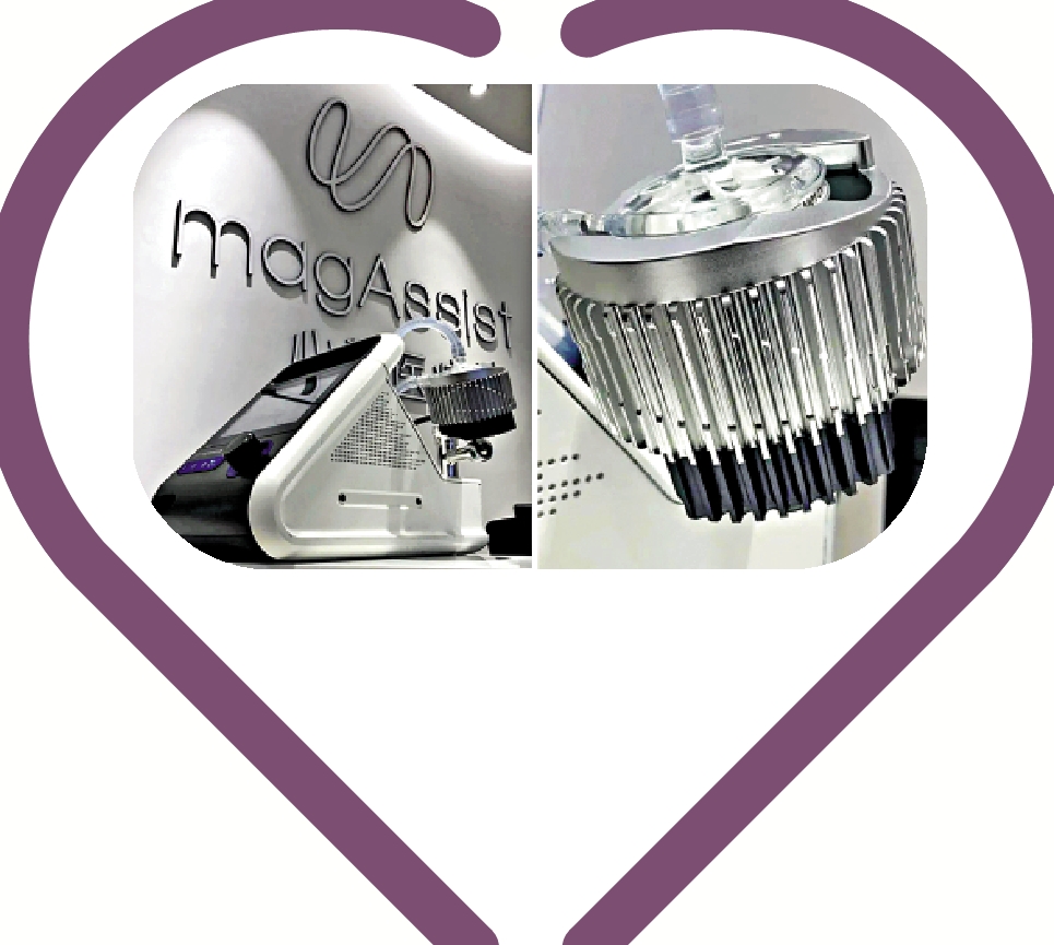 　　圖：蘇州心擎醫療研發的體外磁懸浮人工心臟。/受訪者供圖