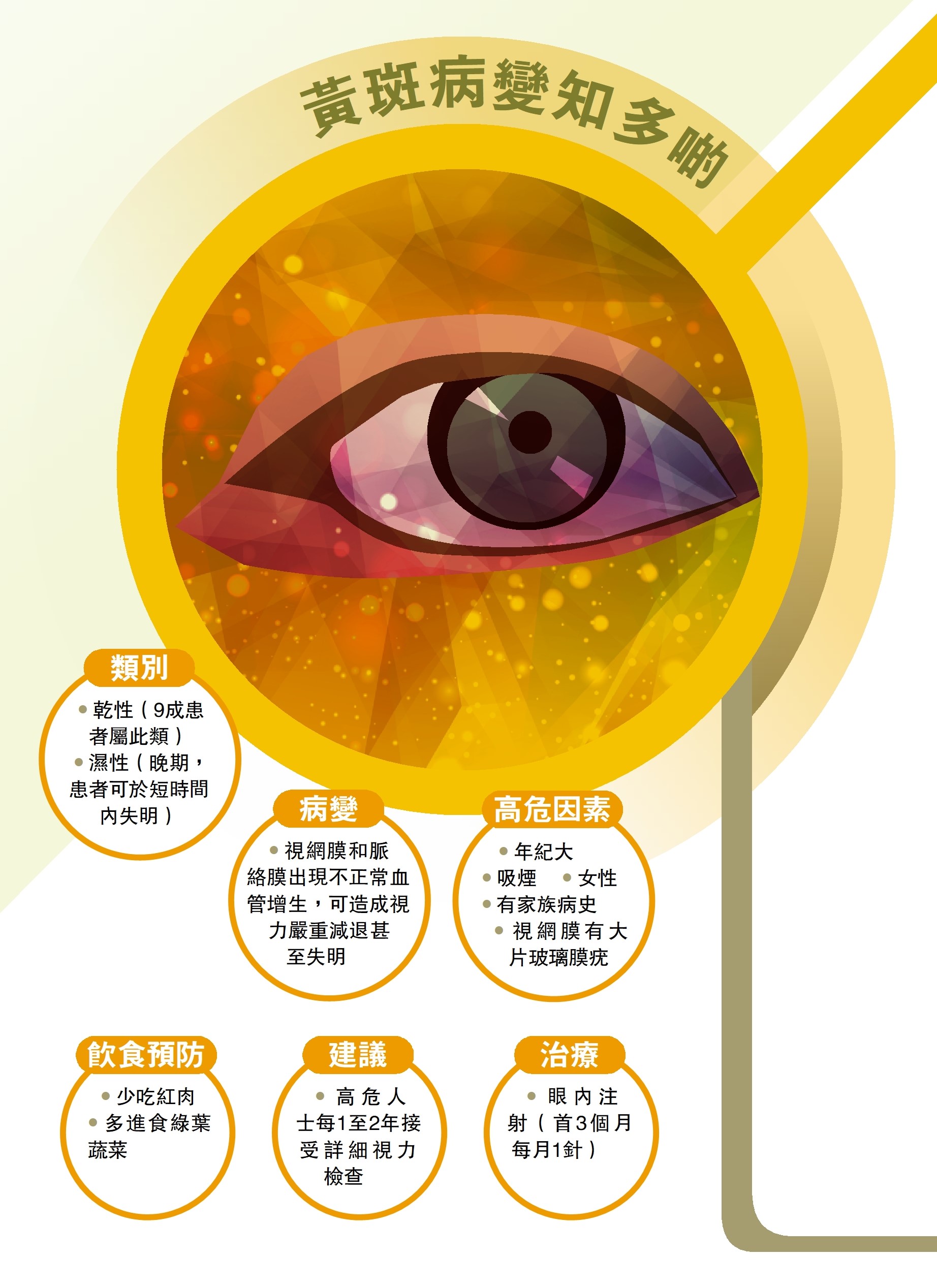 　　圖：黃斑病變知多啲