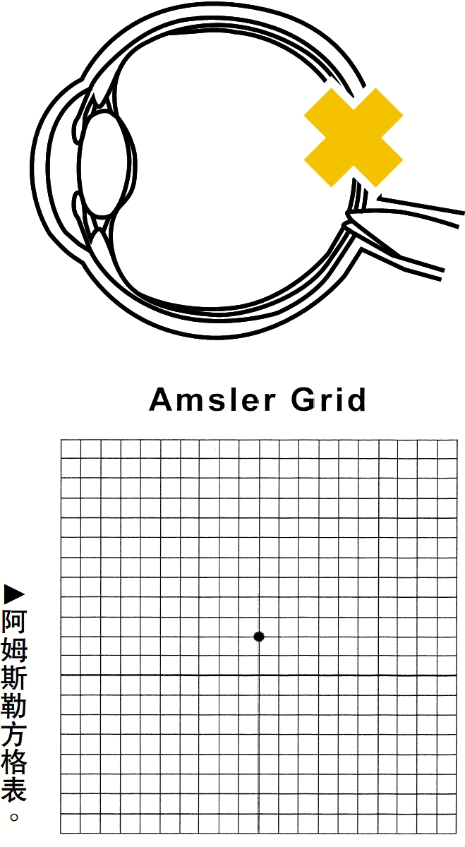 　　圖：阿姆斯勒方格表。