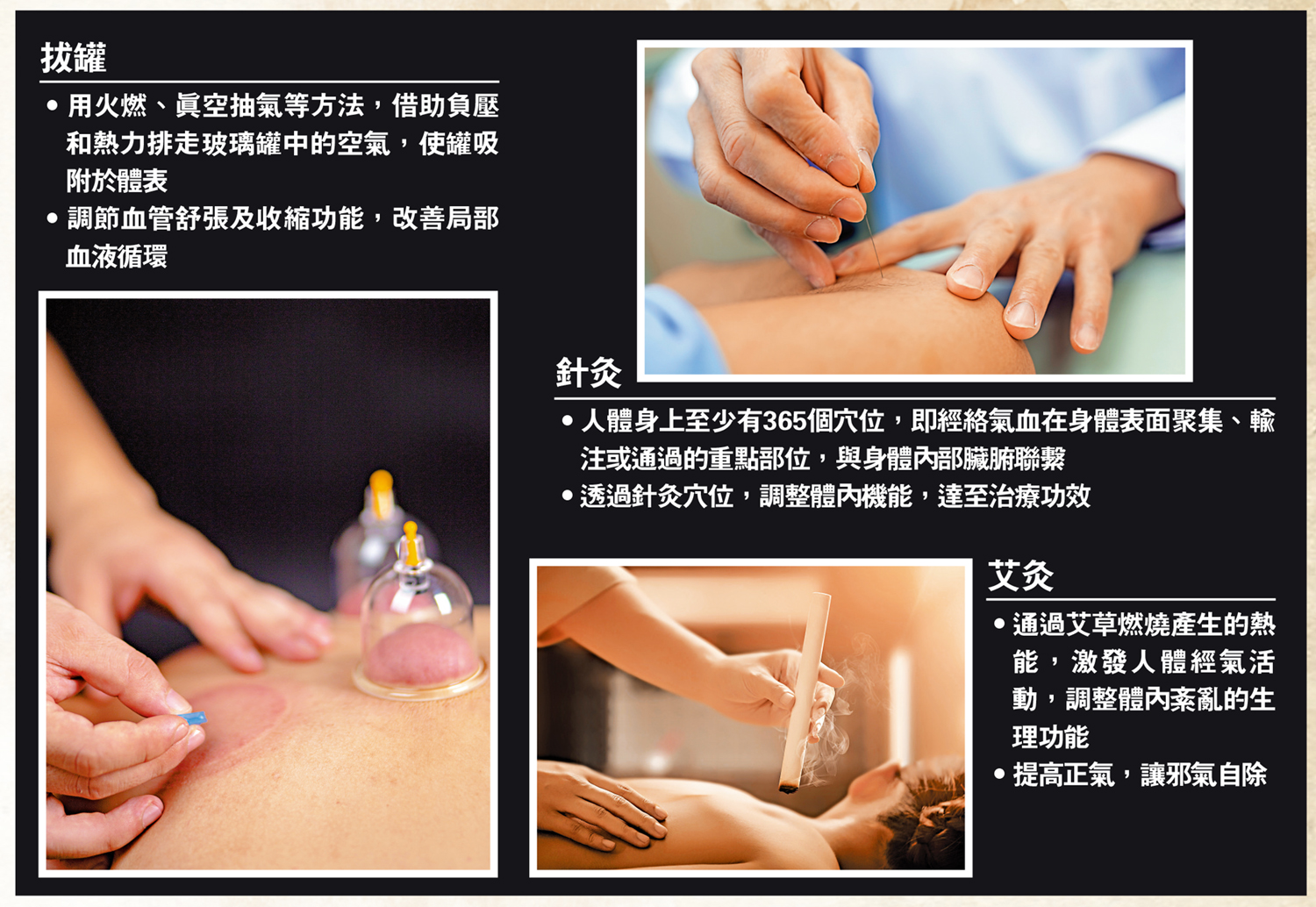 　　圖：拔罐、針灸、艾灸