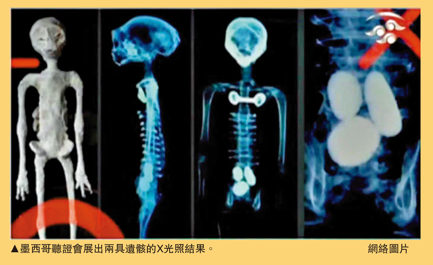 　　圖：墨西哥聽證會展出兩具遺骸的X光照結果。\網絡圖片