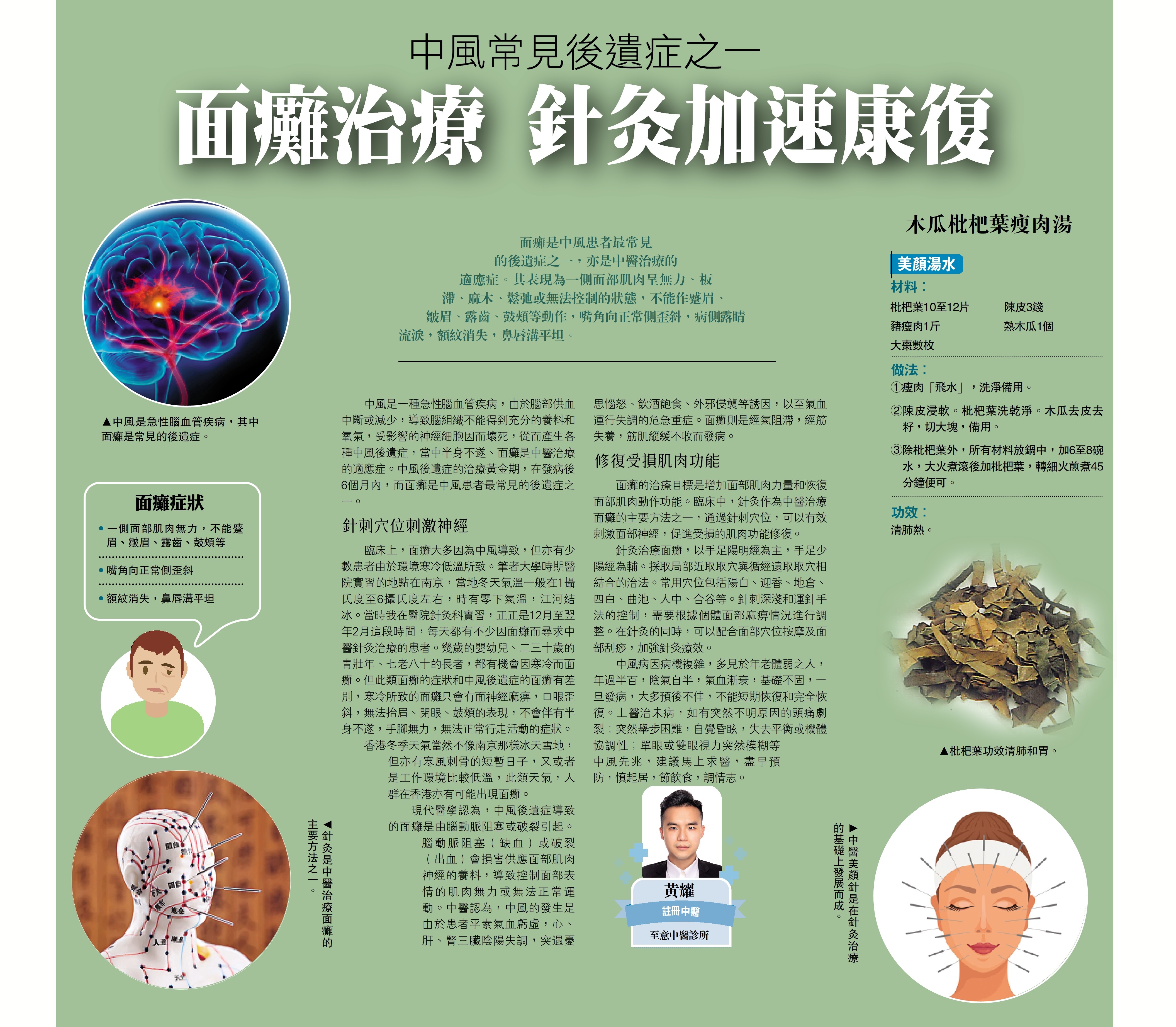 　　圖：中風是急性腦血管疾病，其中面癱是常見的後遺症。