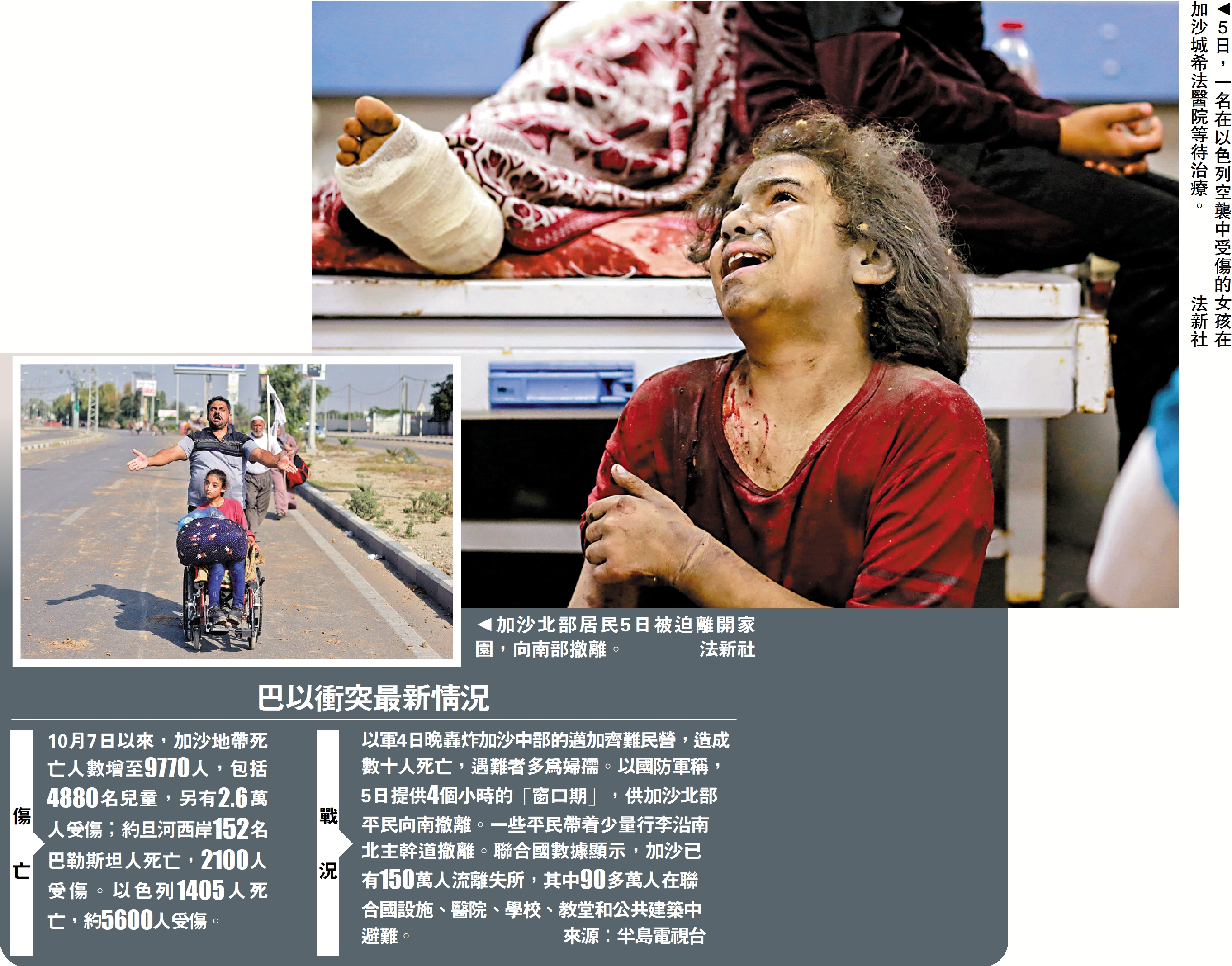 　　左圖：加沙北部居民5日被迫離開家園，向南部撤離。\法新社　右圖：5日，一名在以色列空襲中受傷的女孩在加沙城希法醫院等待治療。\法新社