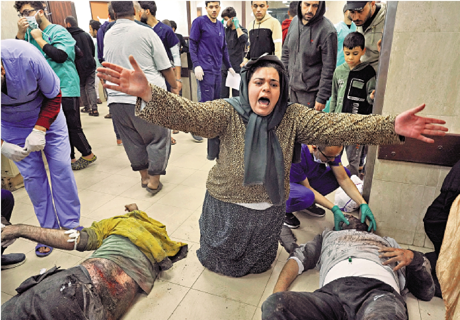 　　圖：在以軍襲擊中受傷的巴勒斯坦人3日被送進加沙中部的醫院。\美聯社