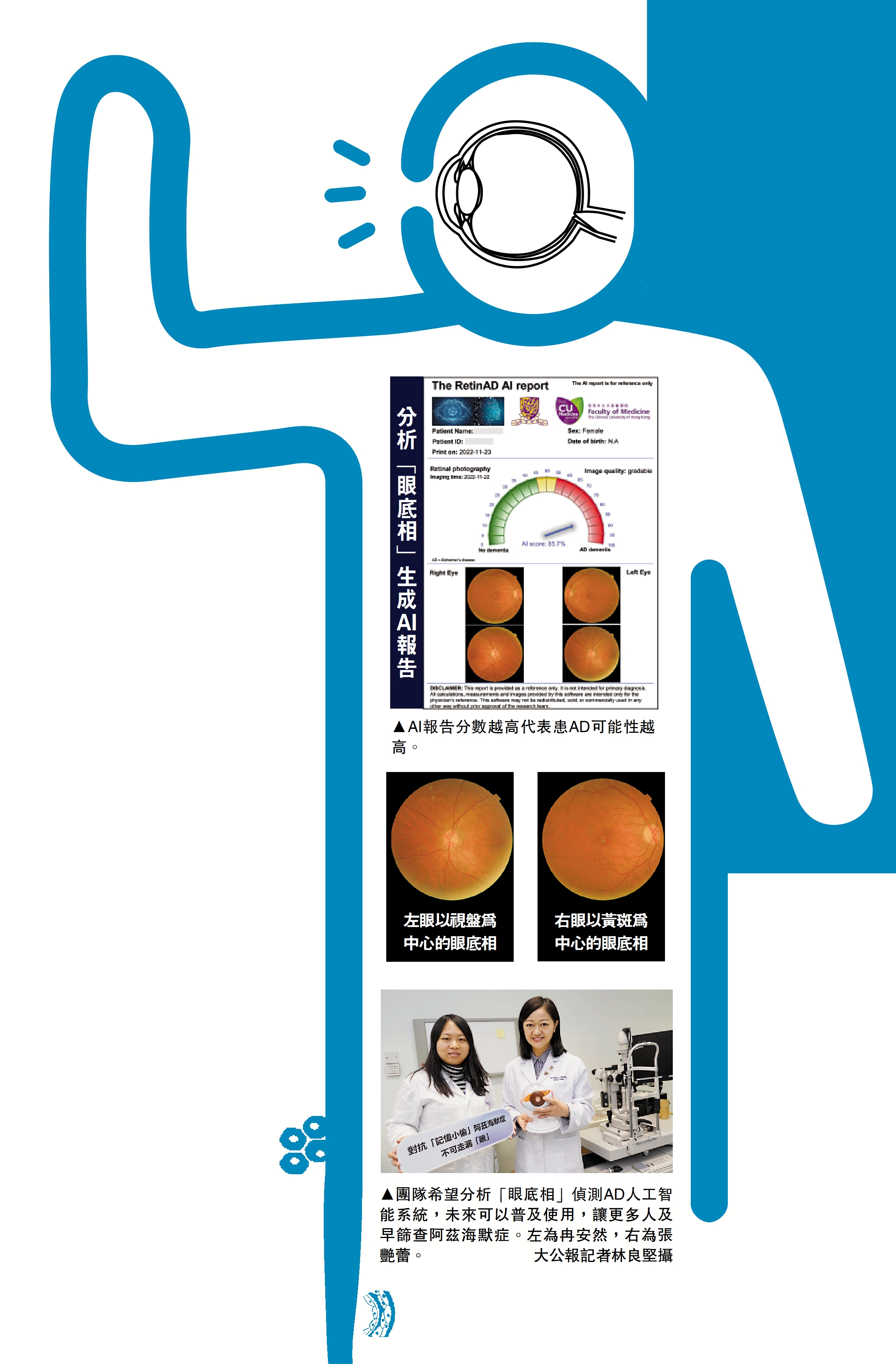 　　圖：團隊希望分析「眼底相」偵測AD人工智能系統，未來可以普及使用，讓更多人及早篩查阿茲海默症。左為冉安然，右為張艷蕾。/大公報記者林良堅攝