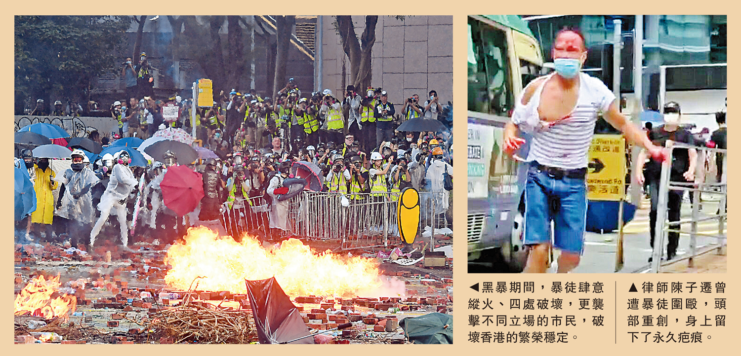 　　左圖：黑暴期間，暴徒肆意縱火、四處破壞，更襲擊不同立場的市民，破壞香港的繁榮穩定。右圖：律師陳子遷曾遭暴徒圍毆，頭部重創，身上留下了永久疤痕。