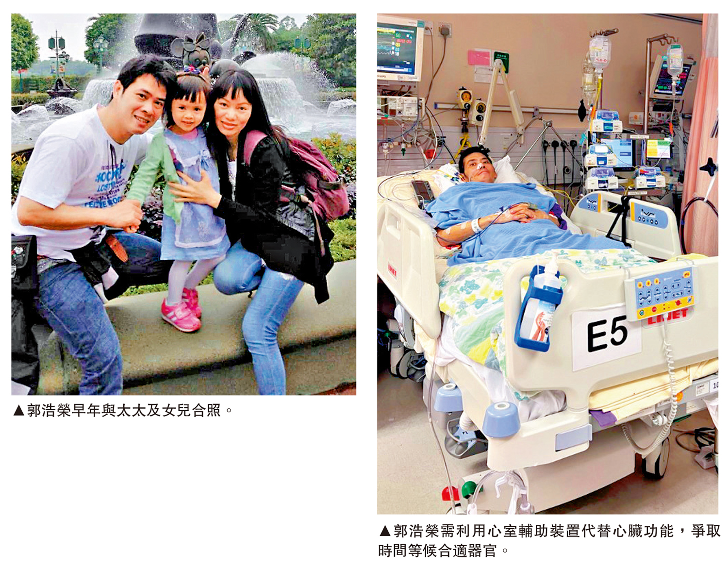　　左圖：郭浩榮早年與太太及女兒合照。右圖：郭浩榮需利用心室輔助裝置代替心臟功能，爭取時間等候合適器官。