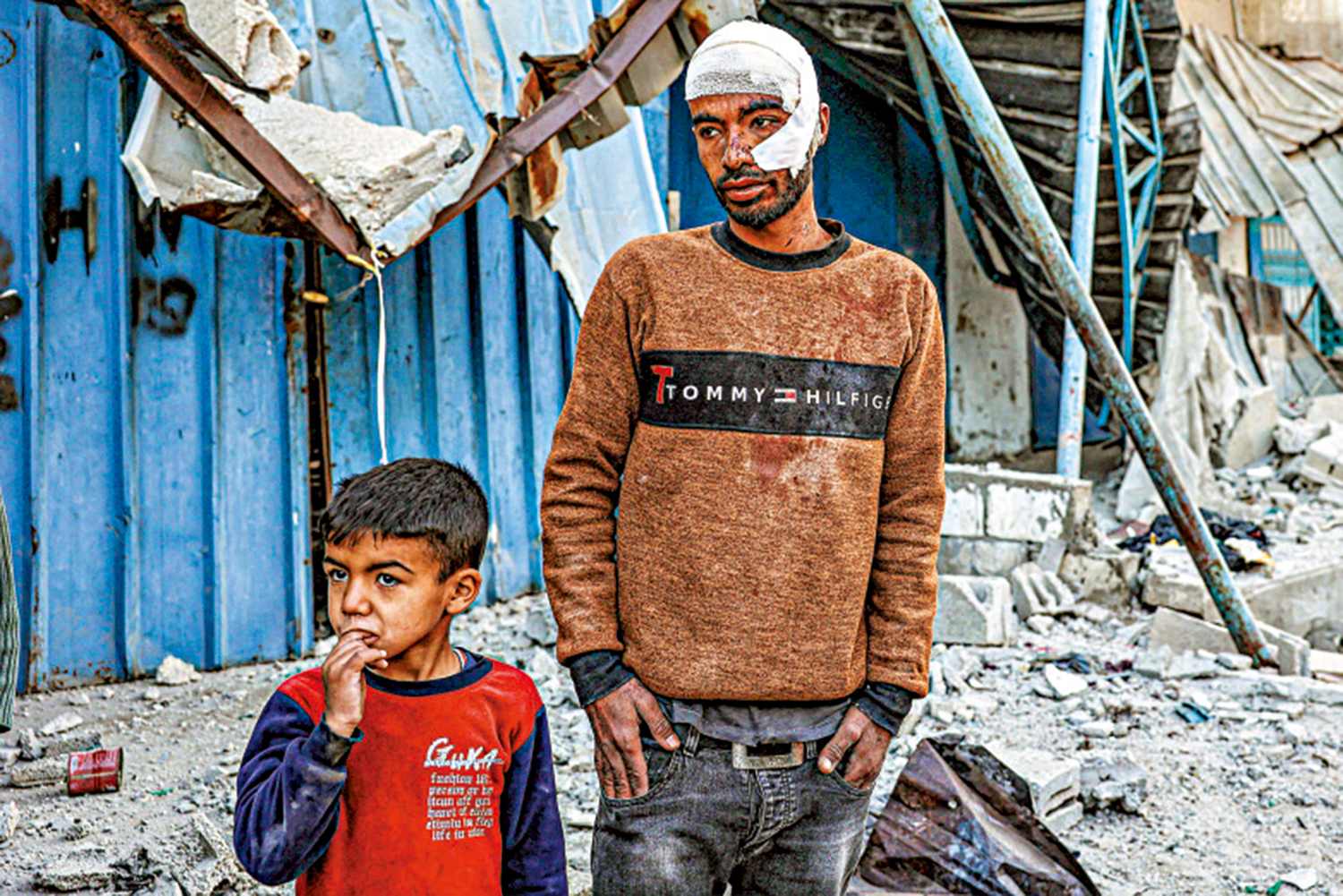 　　圖：加沙南部居民7日在以軍轟炸中受傷。\法新社