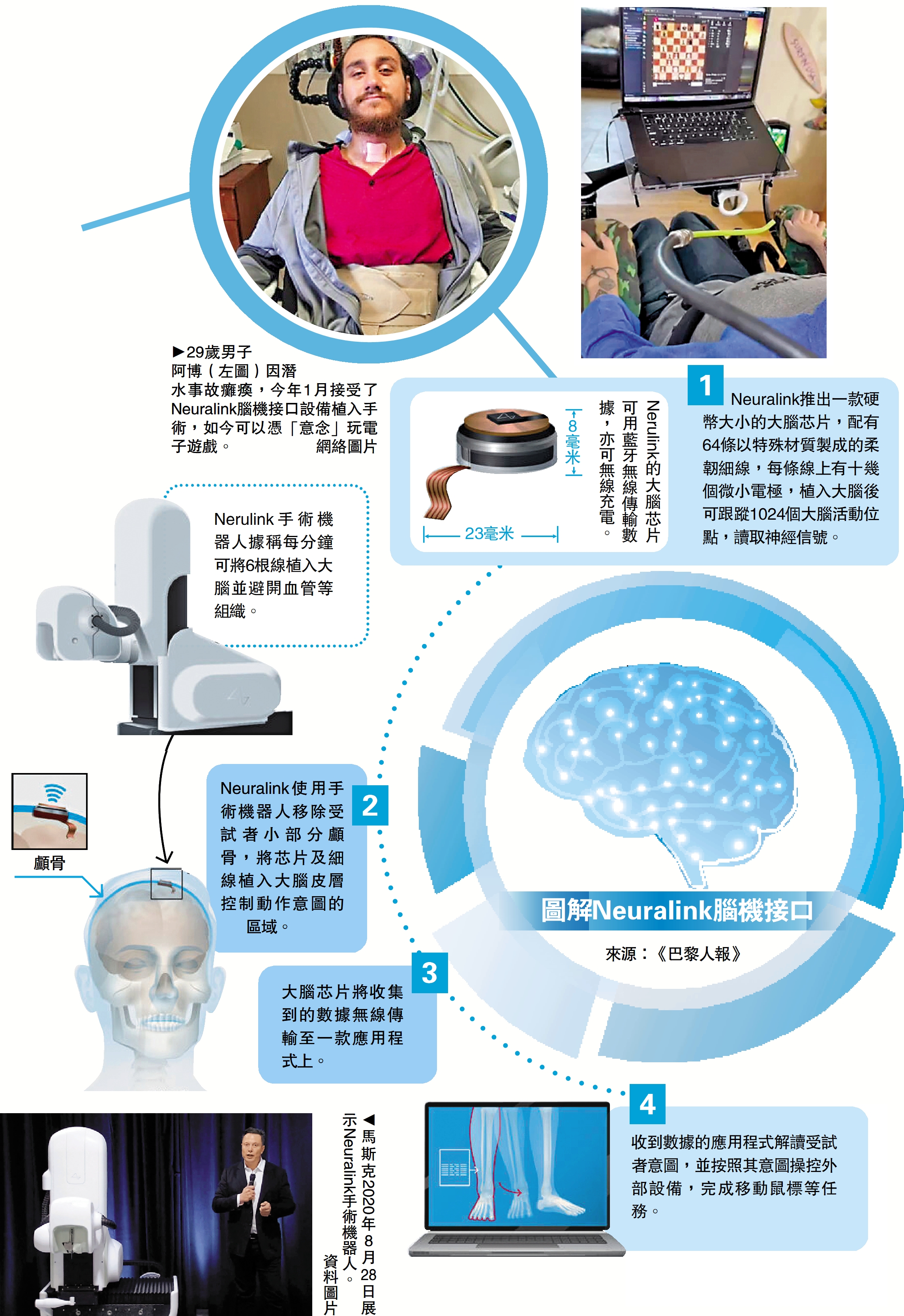 　　圖：圖解Neuralink腦機接口