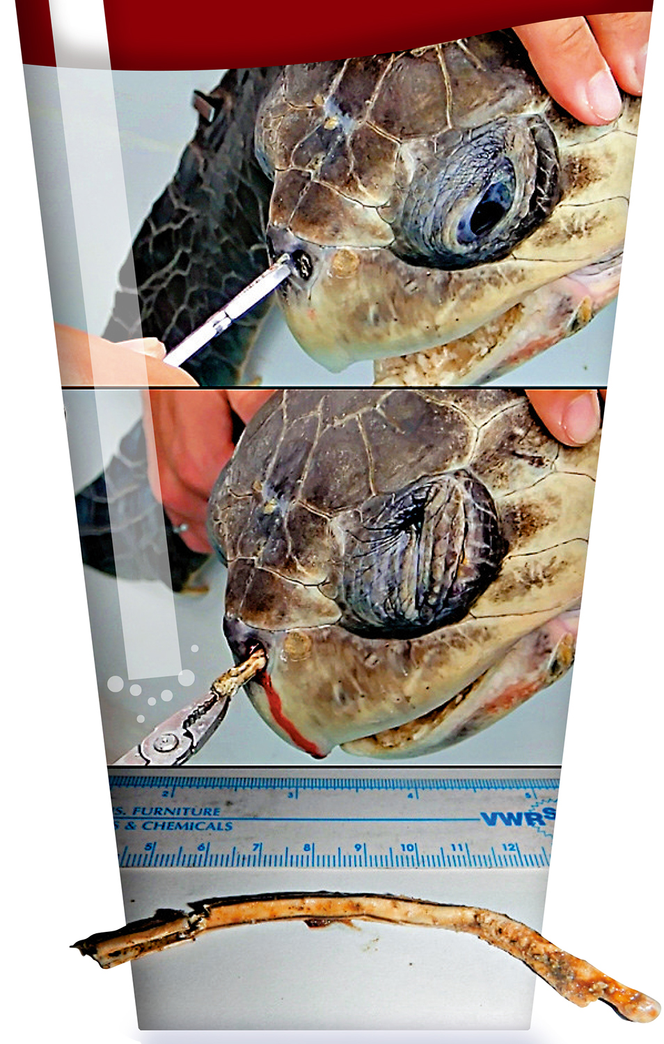 圖:2015年,海洋生物學家在哥斯達黎加發現一隻海龜的鼻孔裏卡了一小節硬質塑膠吸管。\資料圖片