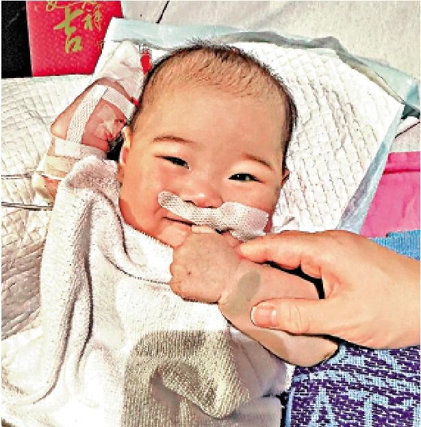 圖:八個月大女嬰祈祈獲內地跨境器官捐贈,完成心臟移植手術。