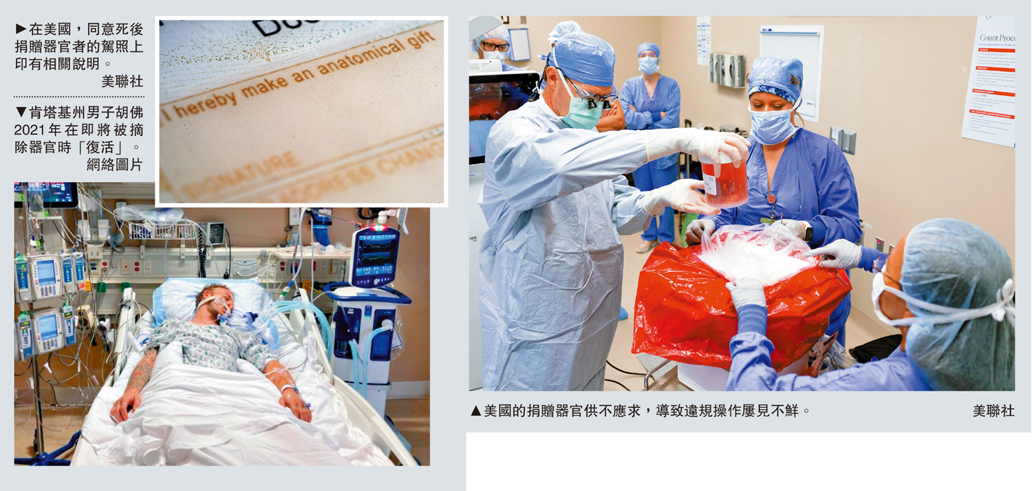 　　左上圖：在美國，同意死後捐贈器官者的駕照上印有相關說明。\美聯社；左下圖：肯塔基州男子胡佛2021年在即將被摘除器官時「復活」。\網絡圖片；右圖：美國的捐贈器官供不應求，導致違規操作屢見不鮮。\美聯社
