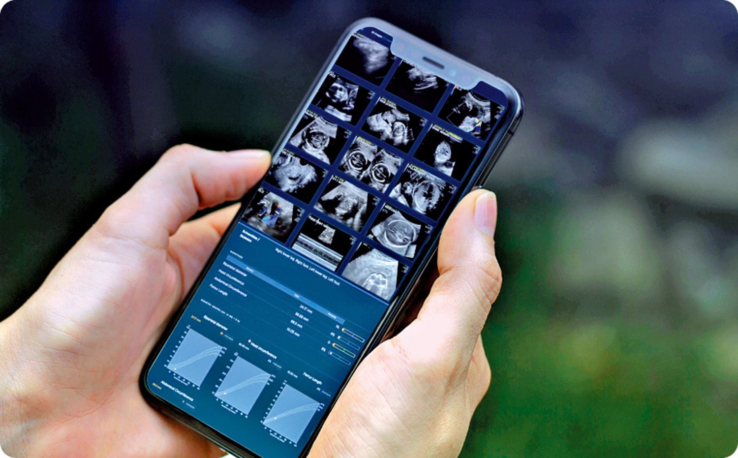 　　圖：AI軟件Sonio Detect可能錯誤識別胎兒身體部位。\網絡圖片