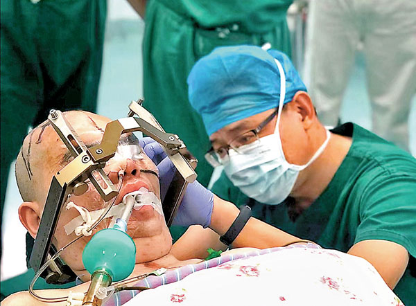 ● 何江弘給微意識患者做腦深部電刺激手術，安裝「大腦起搏器」。 被訪者供圖