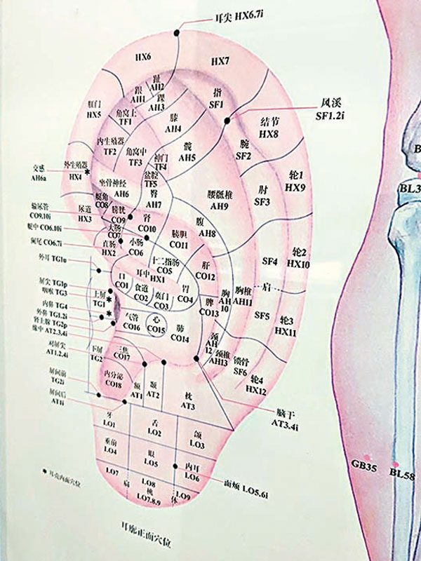 ●耳穴掛圖，可配合耳穴治療。