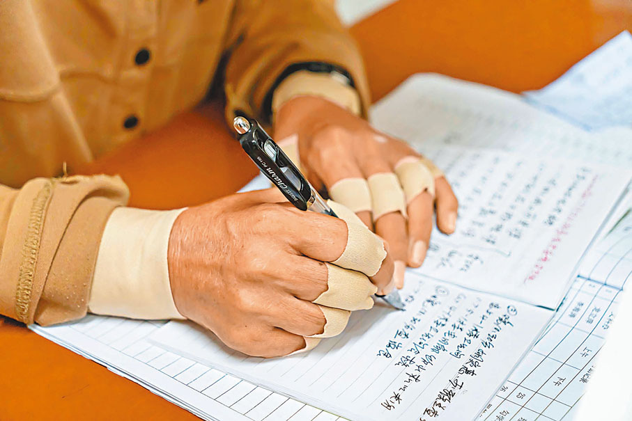 ●由於身患風濕、骨瘤等疾病，張桂梅的雙手、頸背常年貼着膏藥。資料圖片