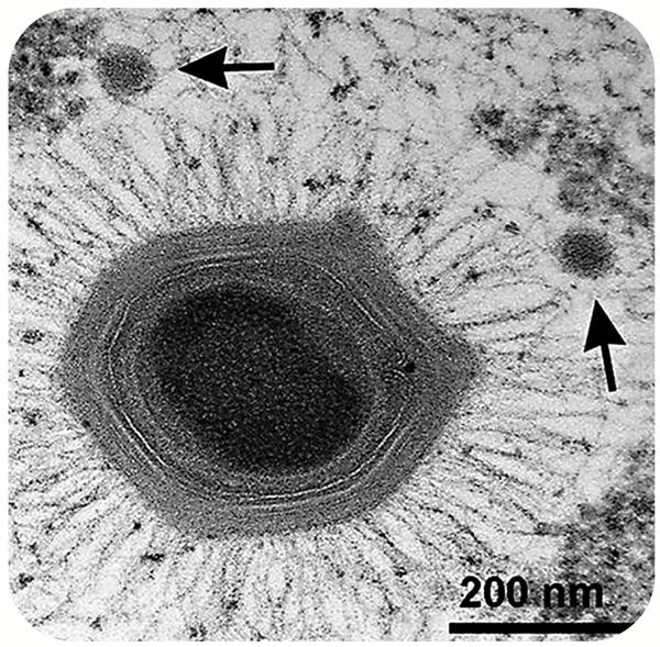 ●一些巨型病毒可以比細菌還要大，動輒帶有幾百段基因。 網上圖片