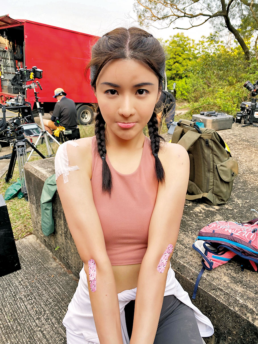 ●陳欣妍因碌落山擦傷了手。