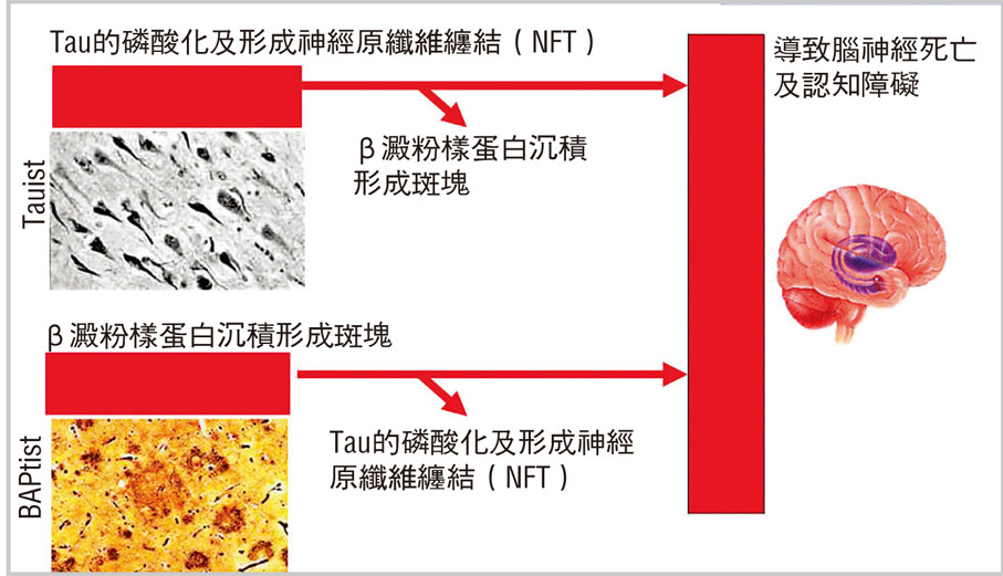 針對阿茲海默症的成因，學界出現了「BAPtist」及「Tauist」兩派學說。 受訪者供圖