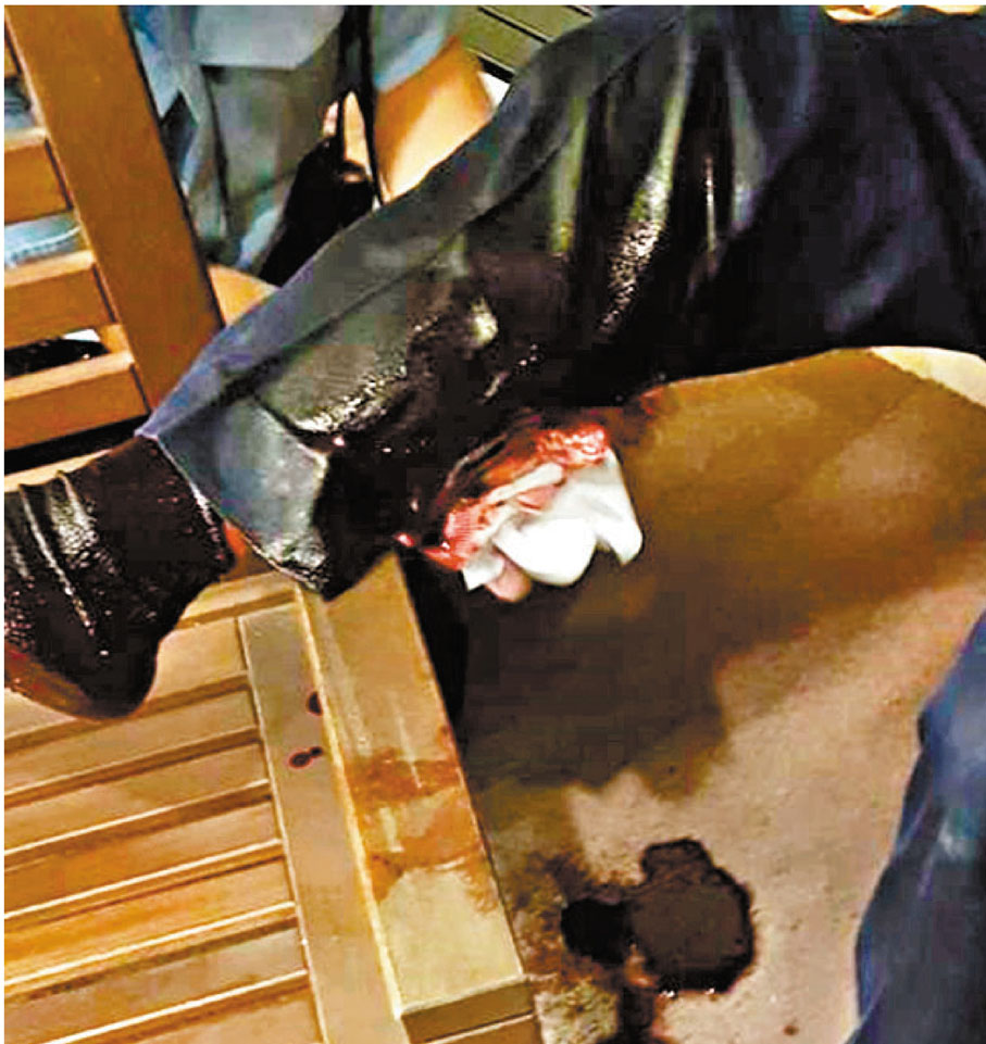 ●輔警等候救護期間右小腿傷口不斷滲血。