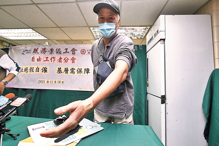 ●亞寶左手受傷，至今仍僵硬無法握拳，每周需覆診兩次，靈活性大不如前。香港文匯報記者  攝