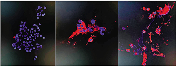 ● 變種病毒的NP蛋白：左為未感染，中、右為感染48小時後。