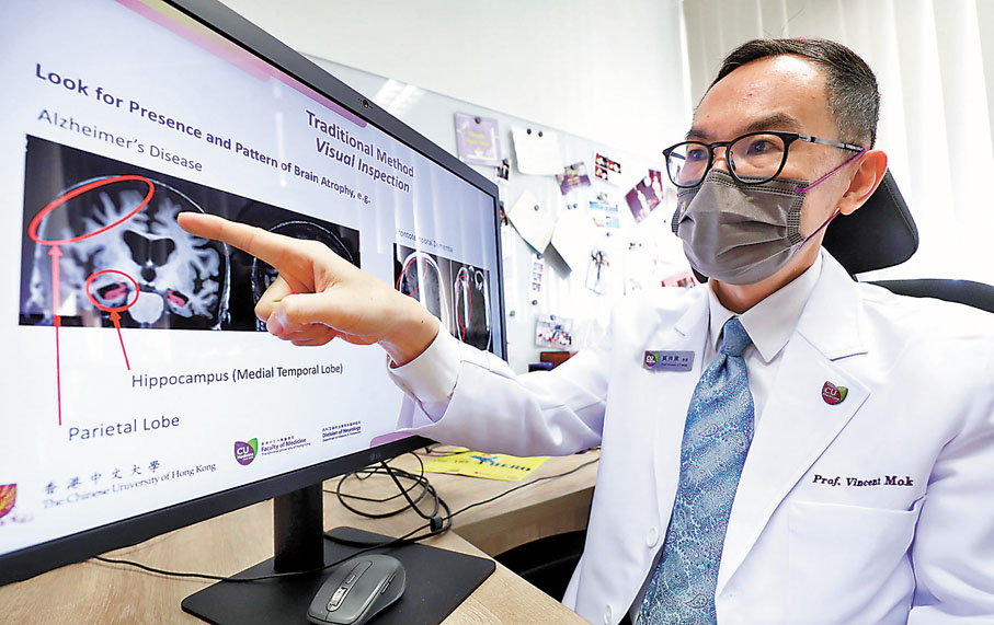 ●莫仲棠表示，在10分鐘內得出直觀可靠的「阿茲海默症腦萎縮指數（AD-RAI）」，可有效協助醫生斷症。 香港文匯報記者  攝
