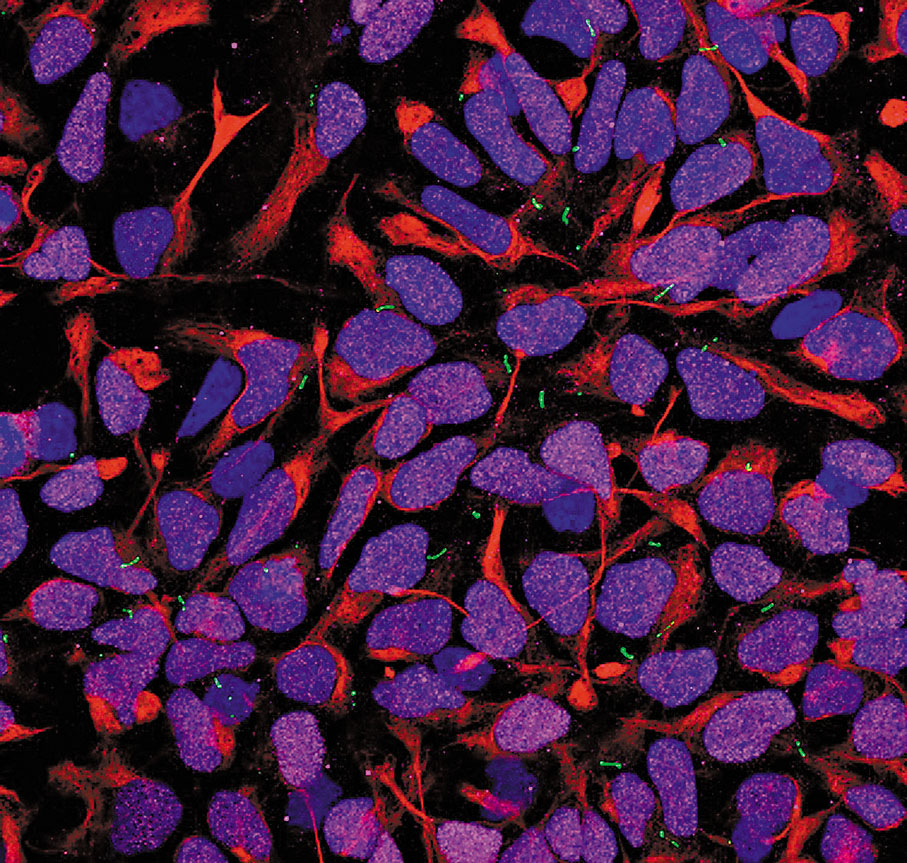 ◆圖像顯示在培養皿上生長的人類神經祖細胞上的初級纖毛（綠色熒光）。受訪者供圖