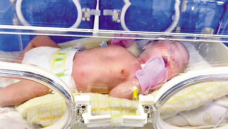 ◆寶寶在保溫箱裏。  受訪者供圖