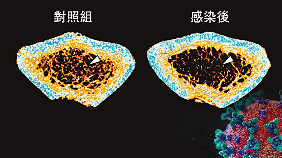 ◆以倉鼠的小梁骨(白色箭頭)比較,感染組(圖右)的骨質密度,低於未感染組(圖左)。港大醫學院供圖
