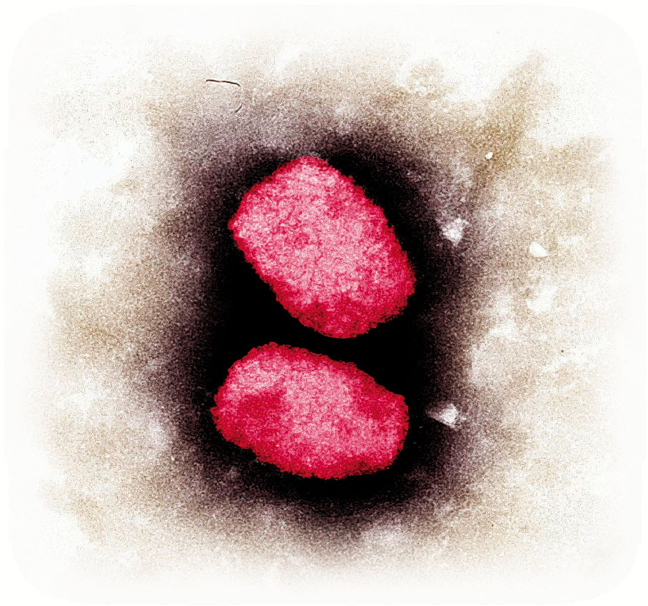 ◆ 電子顯微鏡下的猴痘病毒