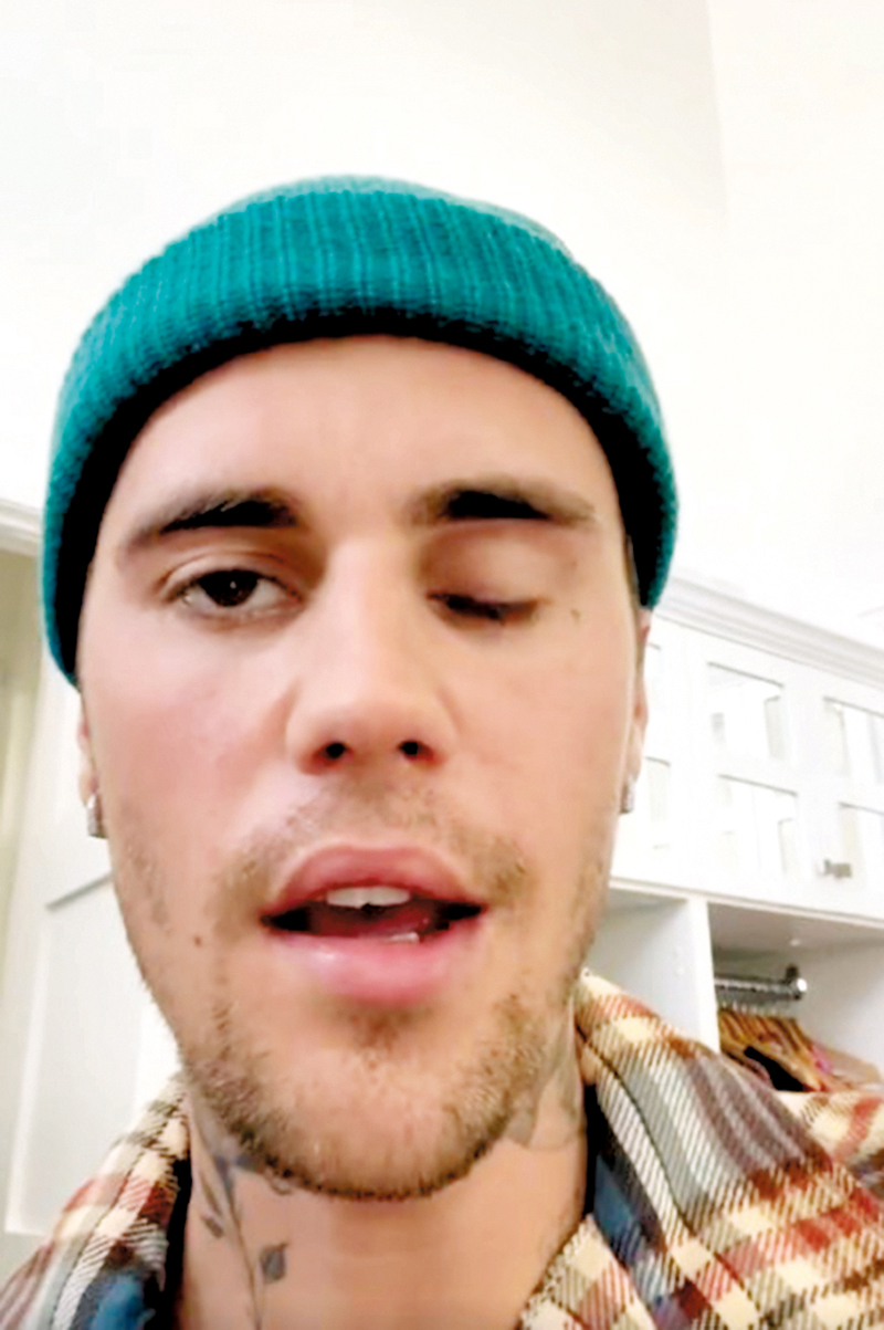 ◆ Justin Bieber面部表情失控。