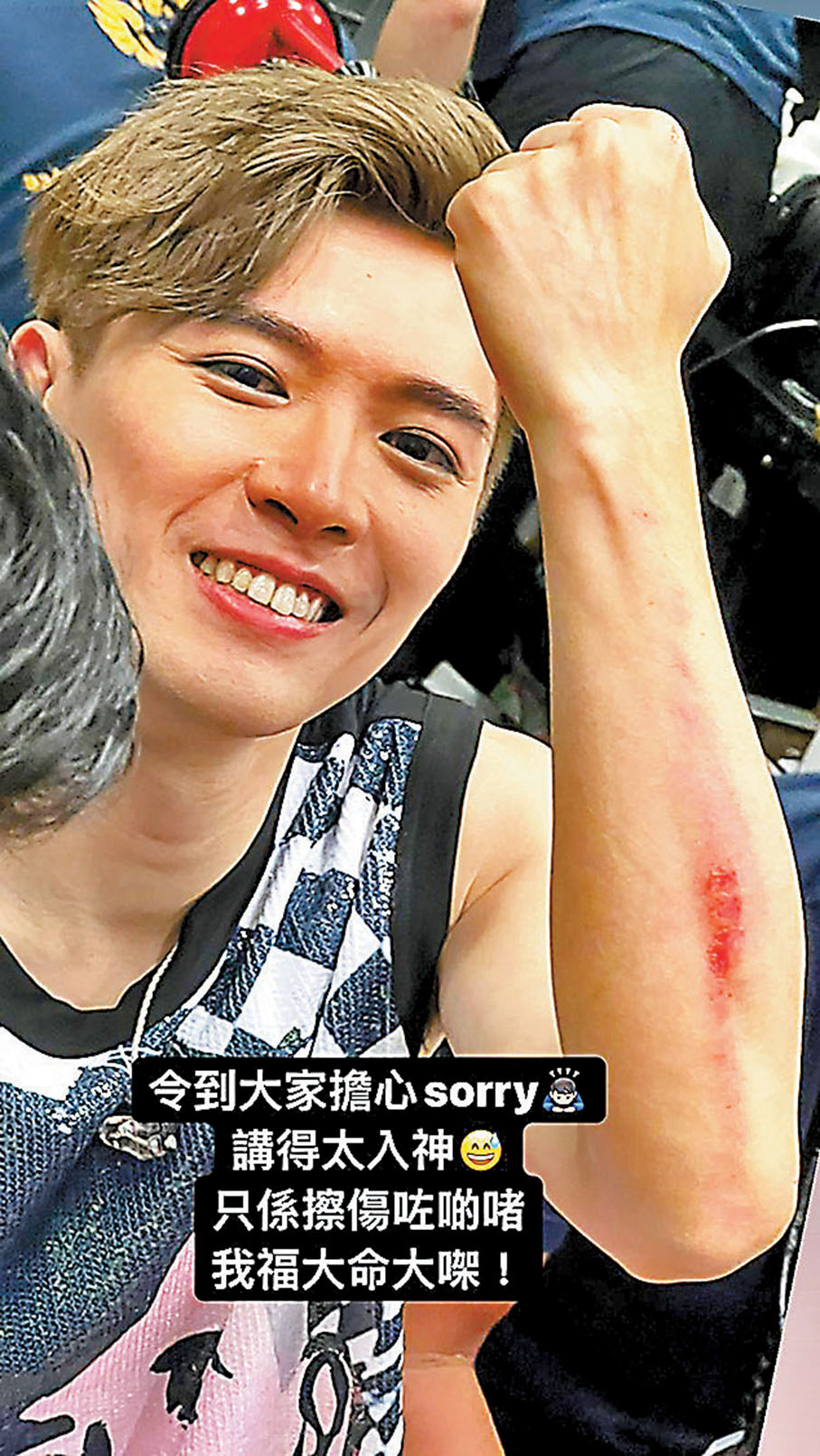 ◆ Frankie早前在社交平台展示自己傷勢。